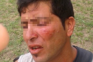 Vecinos echaron a golpes de puños a gente en situación de calle en la zona del parque