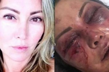 Se conocieron a través de las redes sociales y en la primera cita la molió a golpes