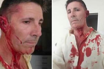 Empleado agredió con golpes de puño al director de una unidad municipal