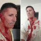 Empleado agredió con golpes de puño al director de una unidad municipal