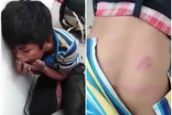 Un niño quedó al borde de la muerte por la brutal paliza que recibió tras robar en un mercado