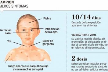 Sarampión: ya ascienden a 48 los casos confirmados en el país