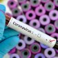 El coronavirus llegó a Australia: confirmaron los primeros cuatro casos