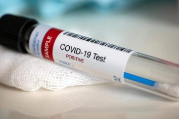 Confirman 929 nuevos casos y 20 muertos en todo el país
