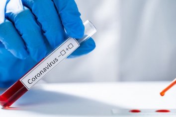 Confirmaron 147 muertes y 7.513 nuevos contagios durante este jueves