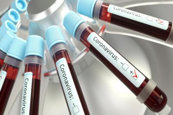 Informaron 235 muertes y 12.141 nuevos casos de covid-19 durante este lunes