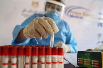 El Ministerio de Salud amplió el criterio para confirmar casos