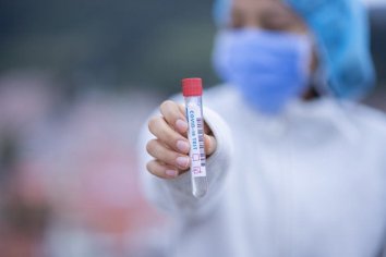 Este sábado se registraron 81 nuevos casos de coronavirus