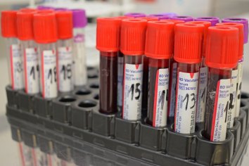 Comenzó a funcionar la red de laboratorios en el Departamento La Paz