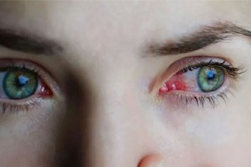 Detectan un nuevo síntoma de contagio en los ojos, de qué se trata y cómo reconocerlo