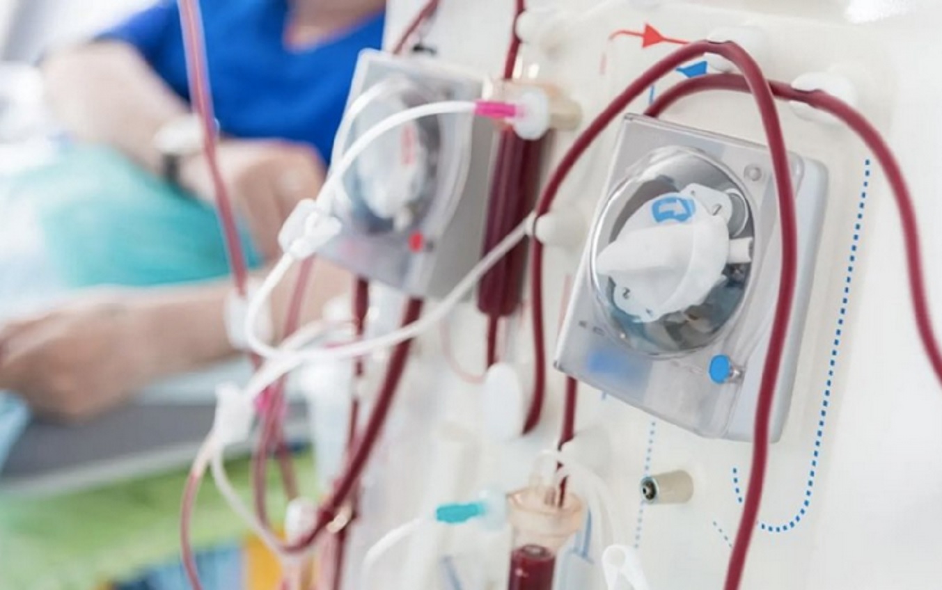 En Argentina, hay 30.000 pacientes en diálisis crónica