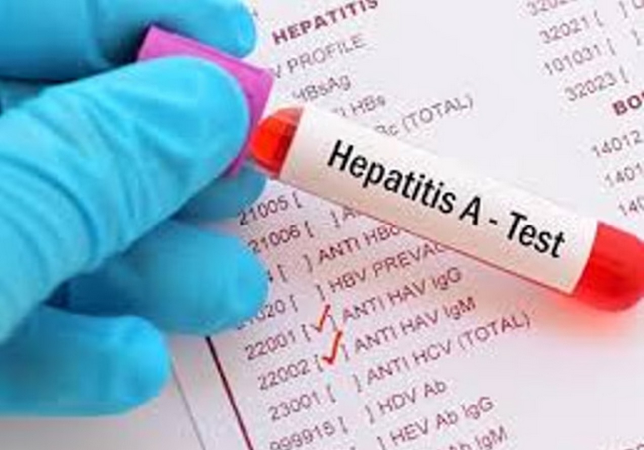 Hepatitis A: la confirmación de 34 nuevos casos pone a Argentina en zona de alerta