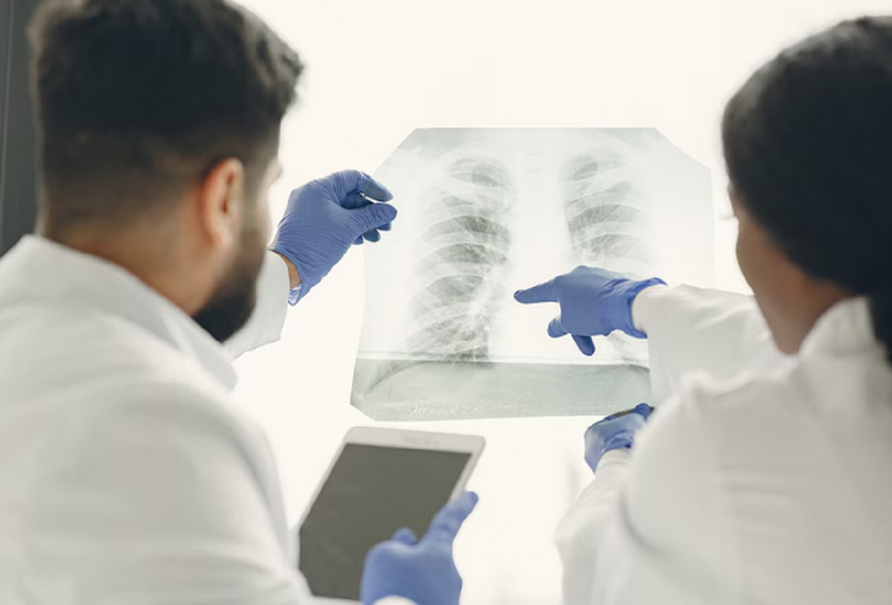 Aumento de casos de tuberculosis en Argentina
